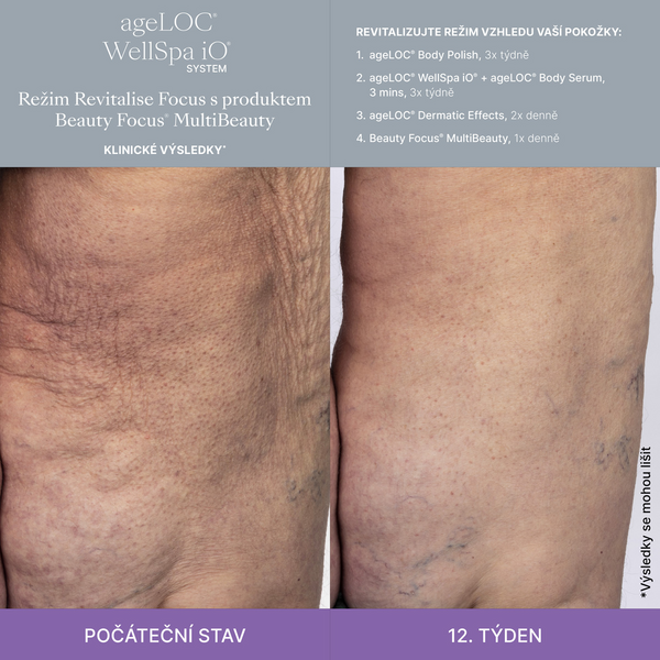Better Together WellSpa iO System Revitalise Focus