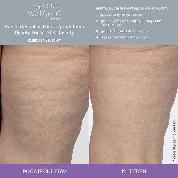 Better Together WellSpa iO System Revitalise Focus Better Together WellSpa iO System Revitalise Focus